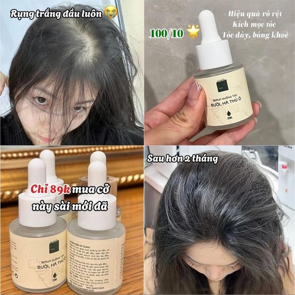 Tiến trình 4 tháng dùng serum xanhtrue